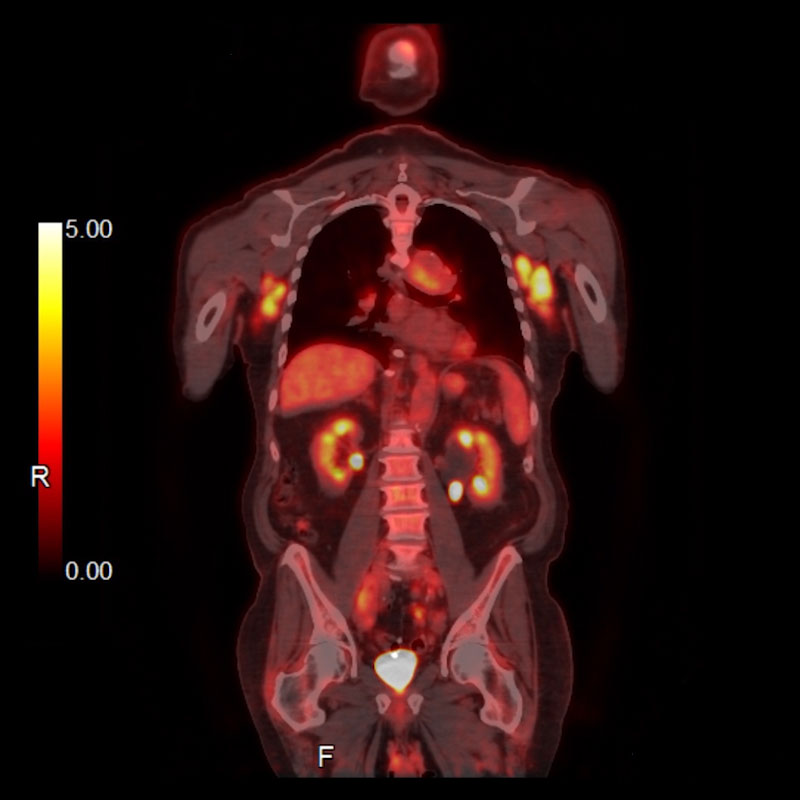 PET CT PET Scan Celesteion PUREViSION Edition PET CT Canon Medical Systems USA