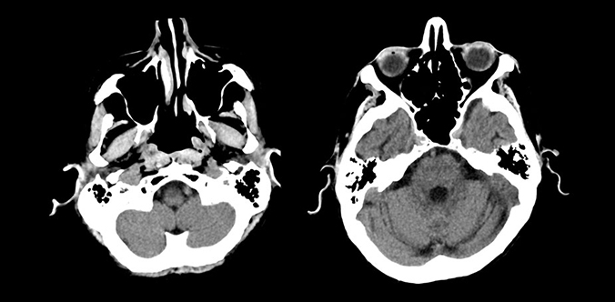 CT Clinical Images