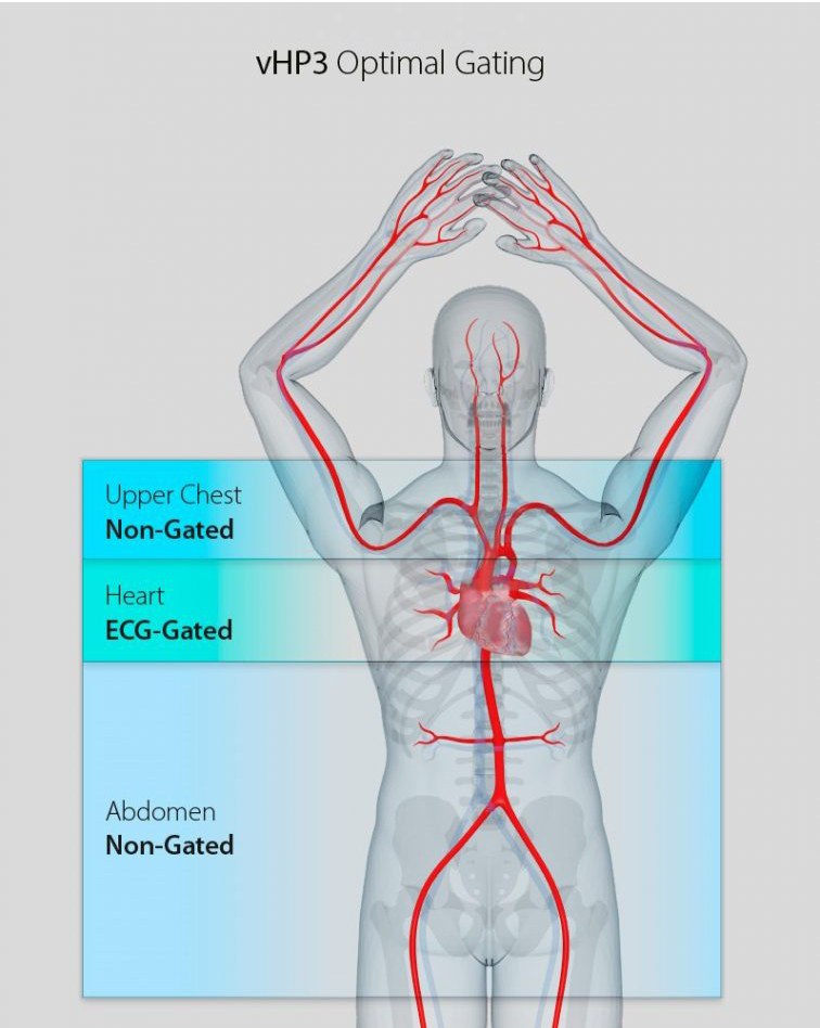 vHP3 ECG-Gated Scan