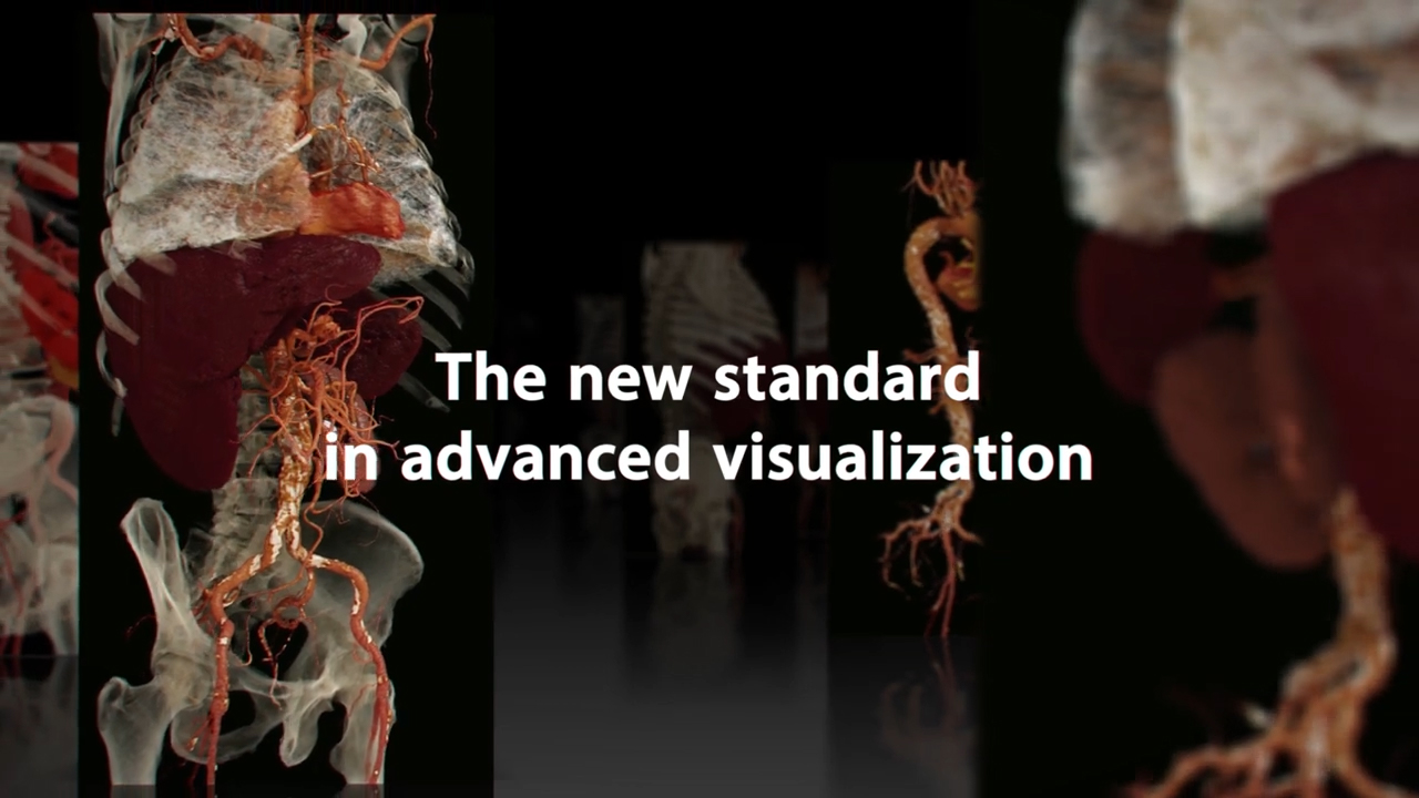 Global Illumination: The New Standard in Advanced Visualization