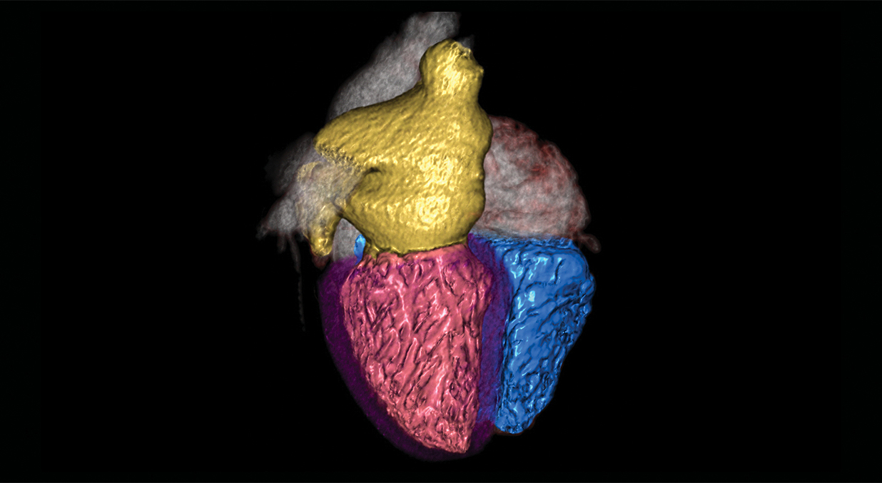 CT Multi-Chamber Cardiac Functional Analysis