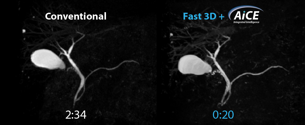 MCRP: Conventional (2:34) vs Fast 3D + AiCE (0:20)