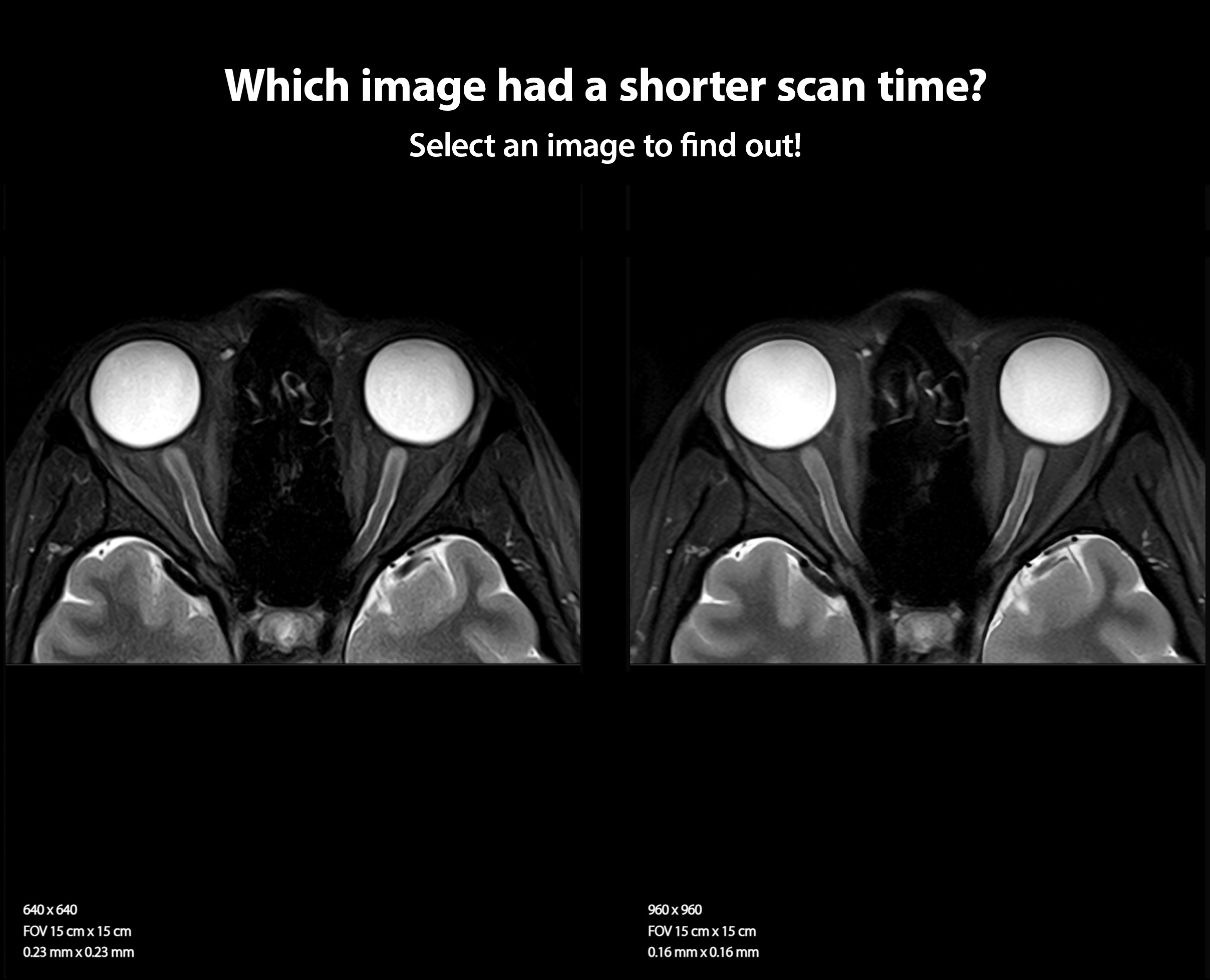 Which image had a shorter scan time? Select an image to find out!