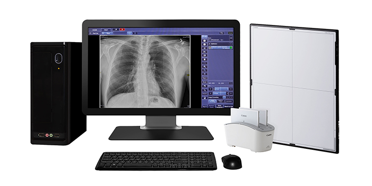 Digital Room Upgrade Kit for Compatible X-ray Systems