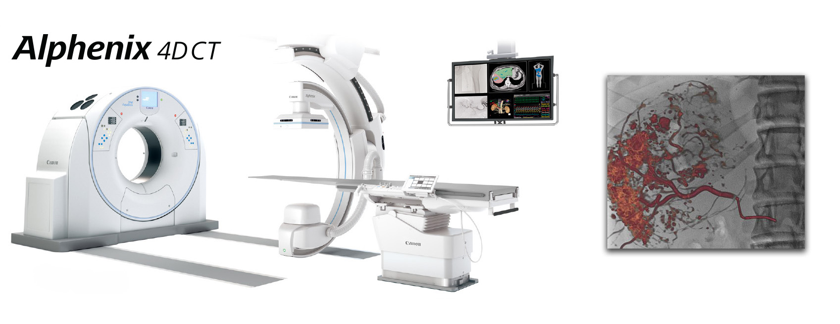 Alphenix 4D CT