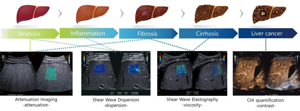 Measurement tools suitable for evaluating various stages of liver disease