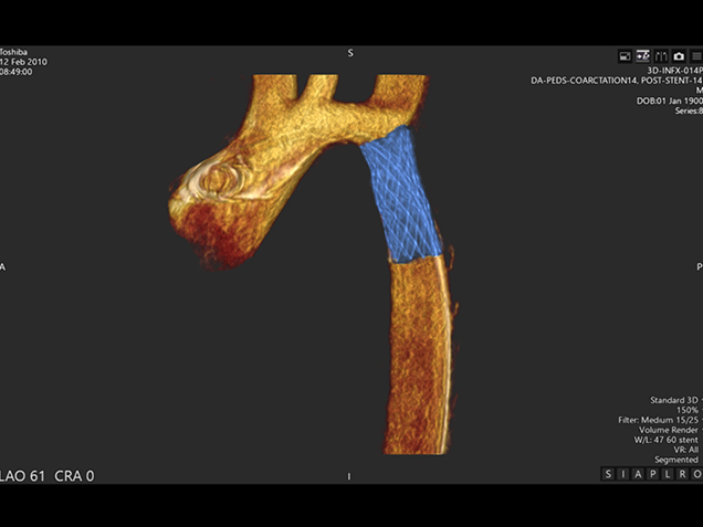 3D Imaging