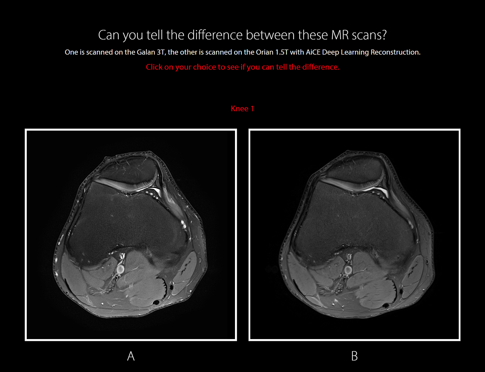 aice-challenge-magnetic-resonance-promotion-canon-medical-systems-usa