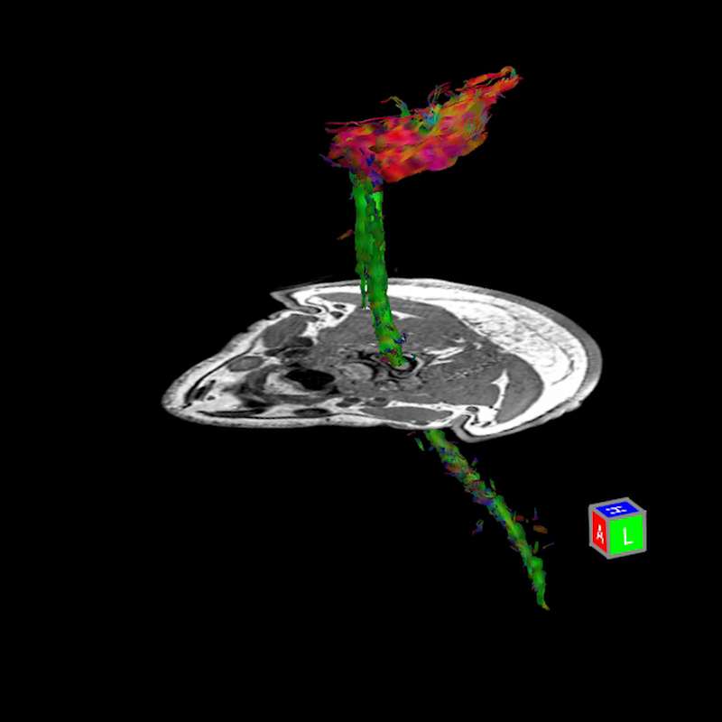 Pianissimo Zen Diffusion