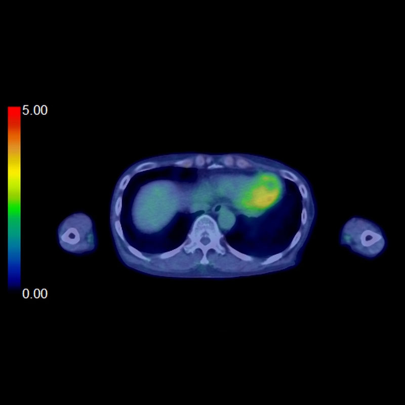 SEMAR, Skull to Mid-Thigh Scan
