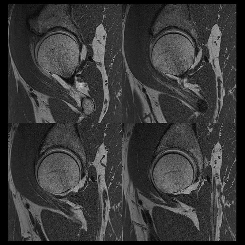 Orthopedic | Vantage Galan 3T Clinical Gallery | MRI | Magnetic ...