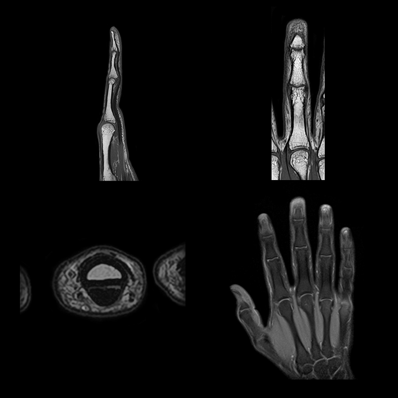 Vantage Orian 1.5t Clinical Gallery Of Orthopedic 