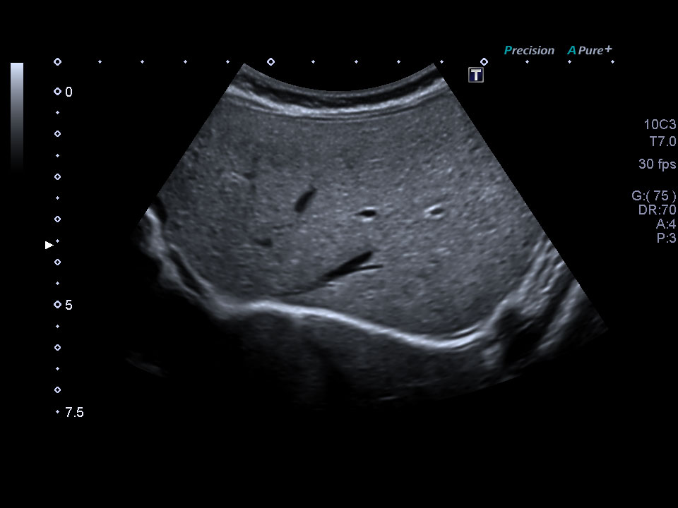 Liver 2-Month-old