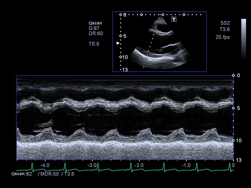 Clinical Gallery Xario Platinum Series Ultrasound Products