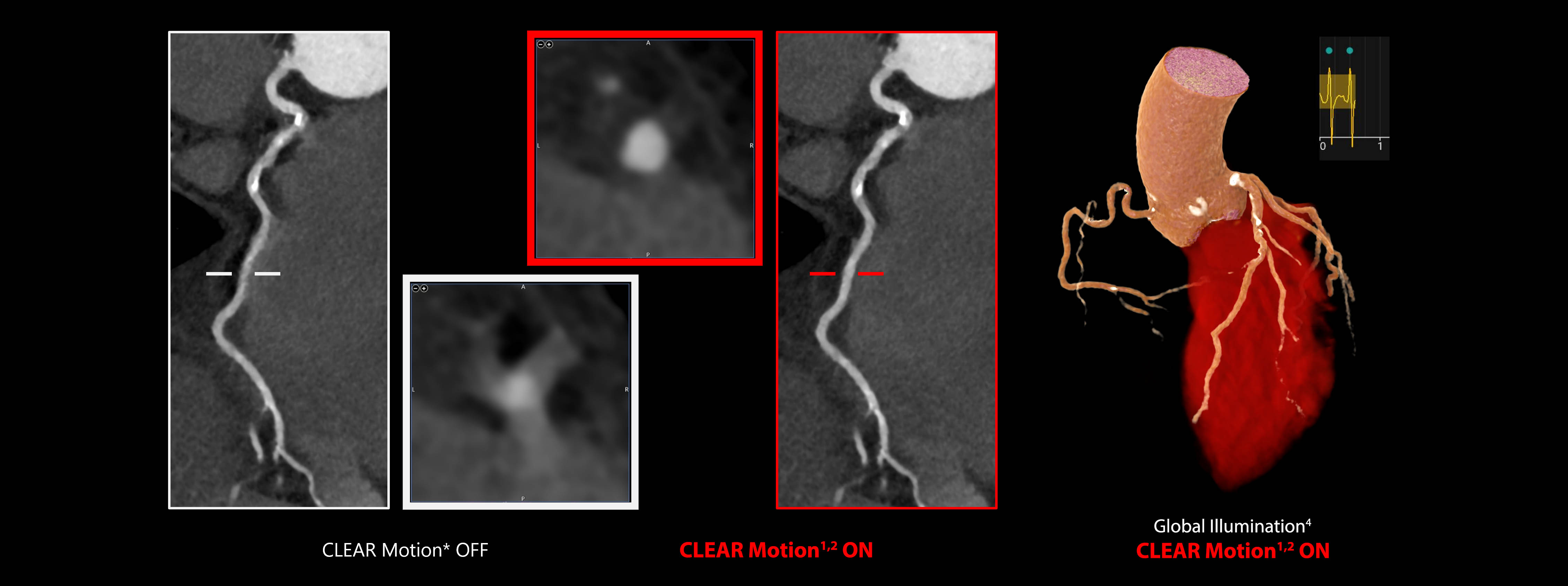 CLEAR Motion: 175 BPM