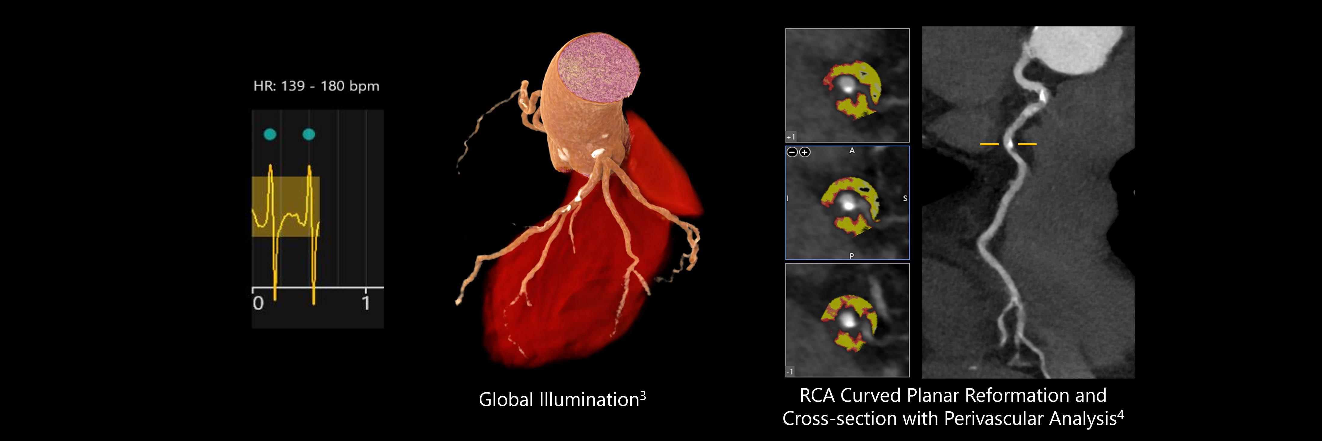 Cardiac Motion Compensation with CLEAR Motion