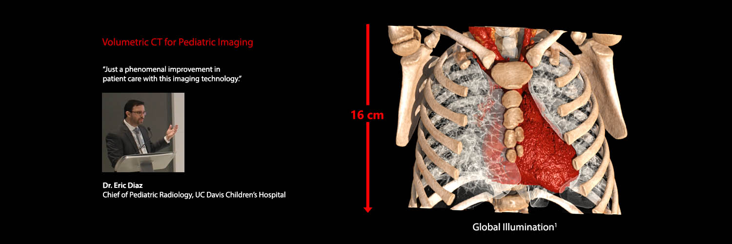2 year old - Volume Chest