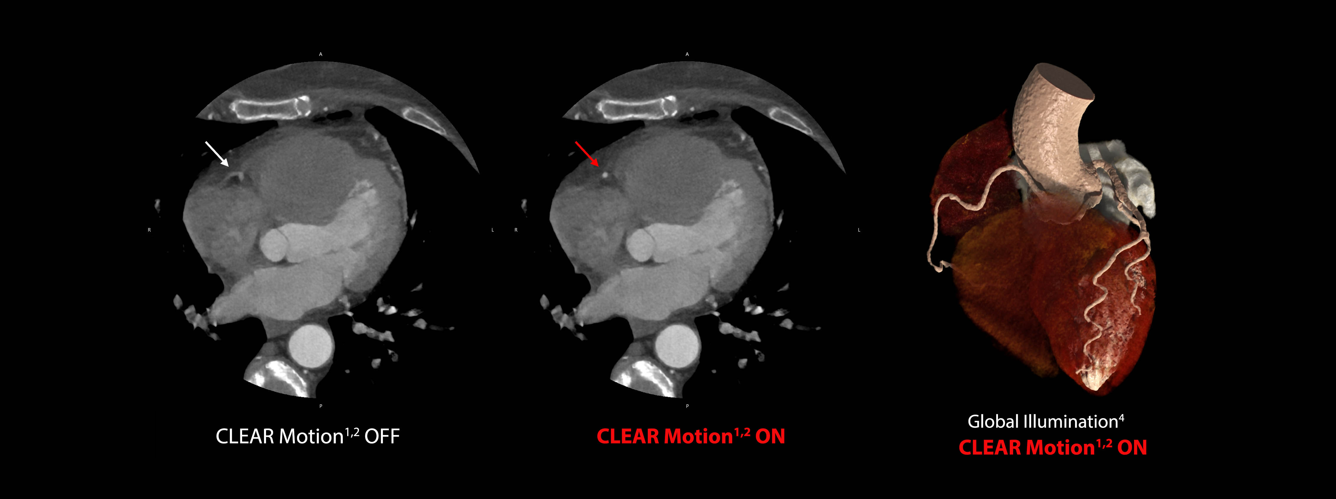 CLEAR Motion Cardiac