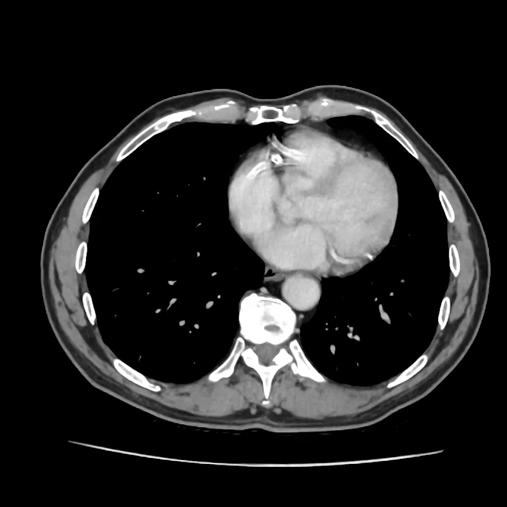 Axial Abdomen