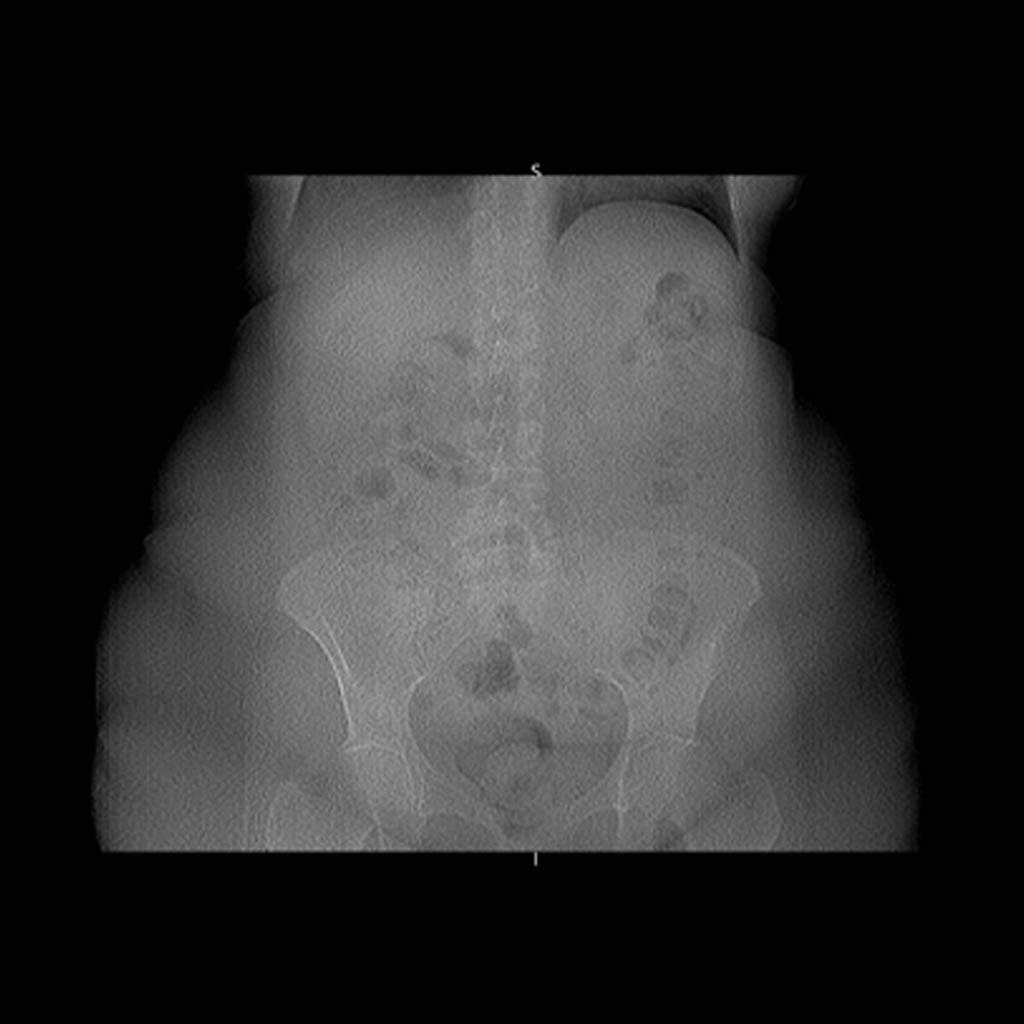 Lower Spine Scan