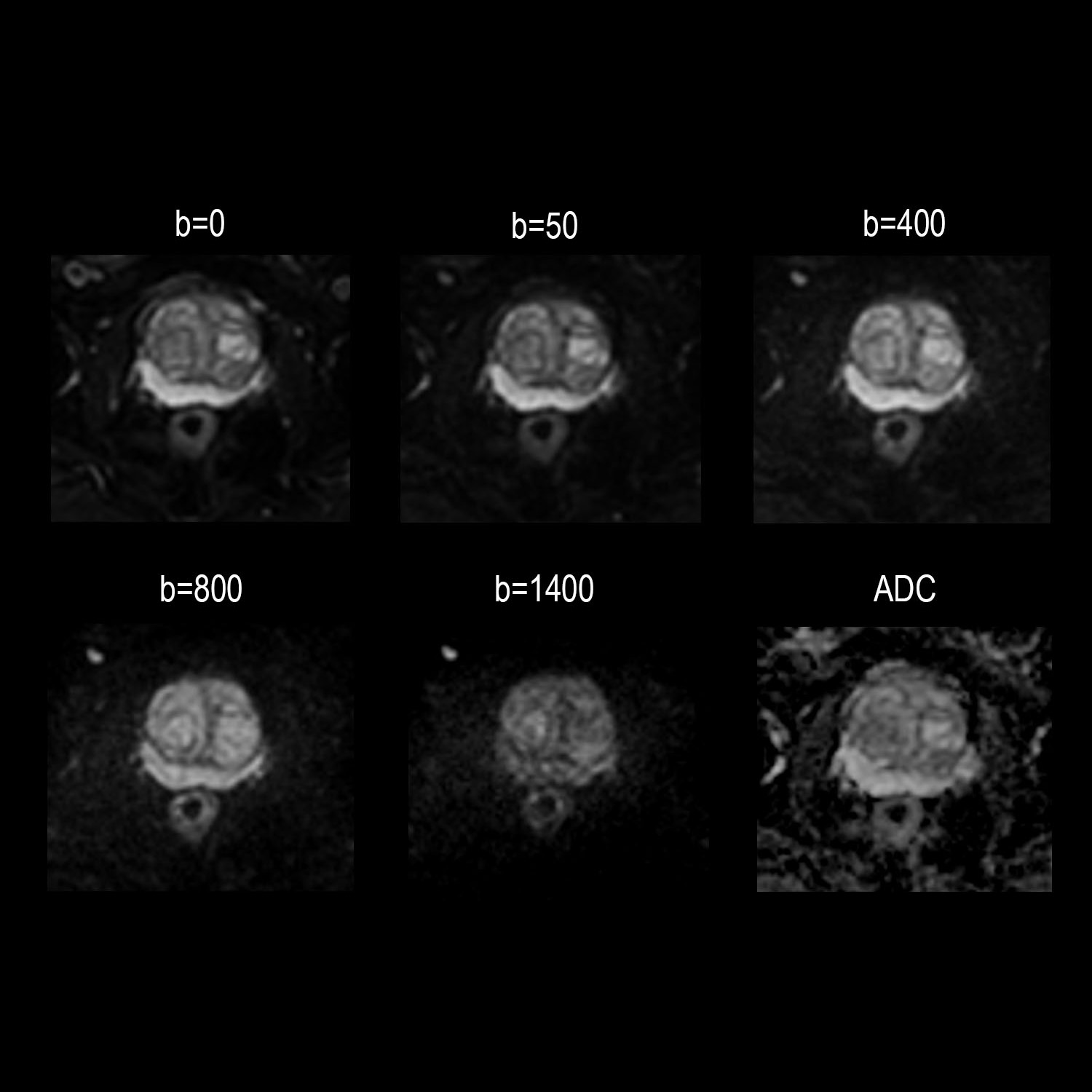 Routine Prostate Imaging with AiCE