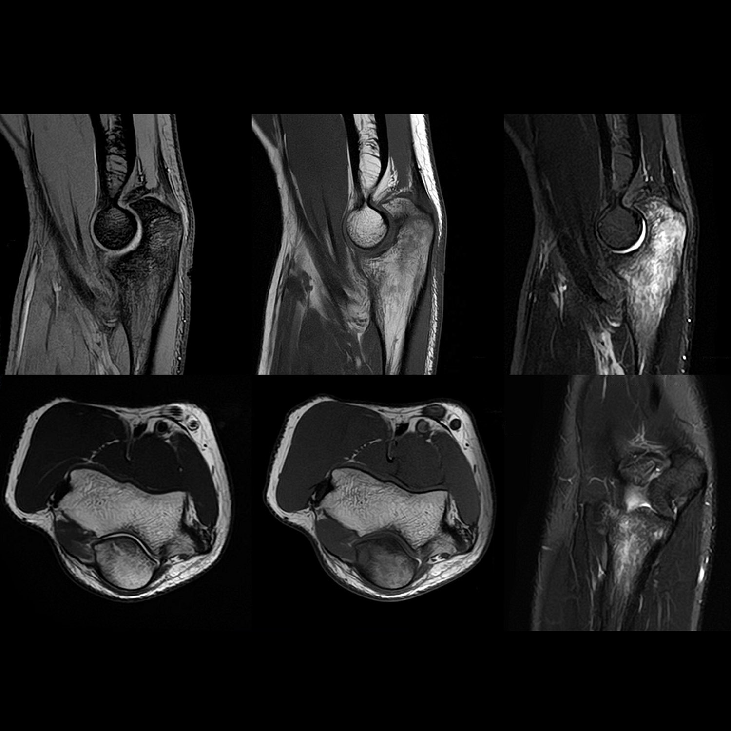 Routine Elbow Imaging
