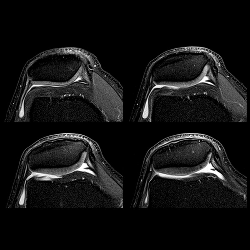 Orthopedic Clinical Gallery | Vantage Titan 1.5T ...