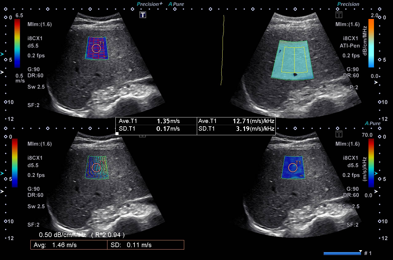 Quad View Display