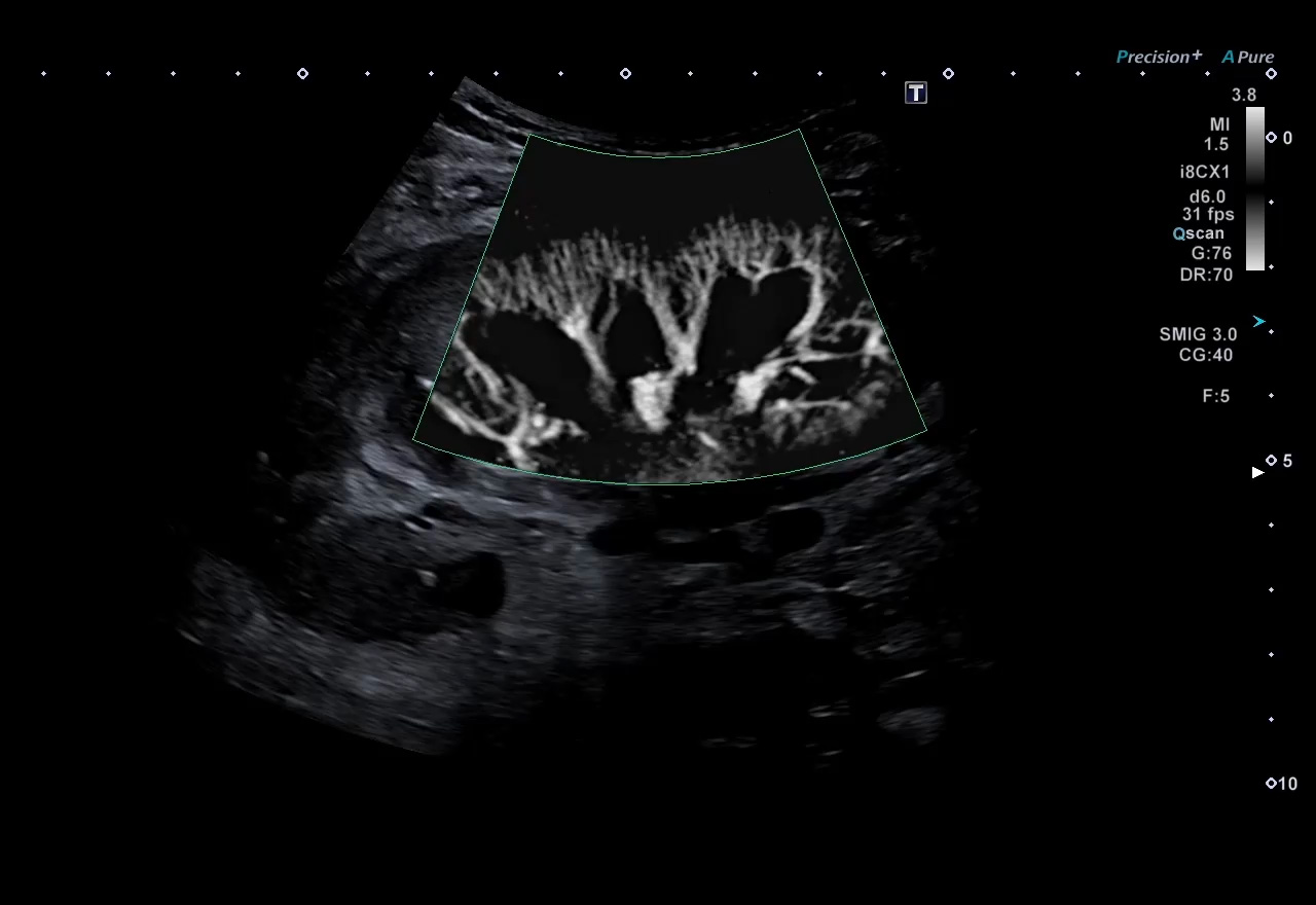 Kidney vasculature with mSMI Gen 4