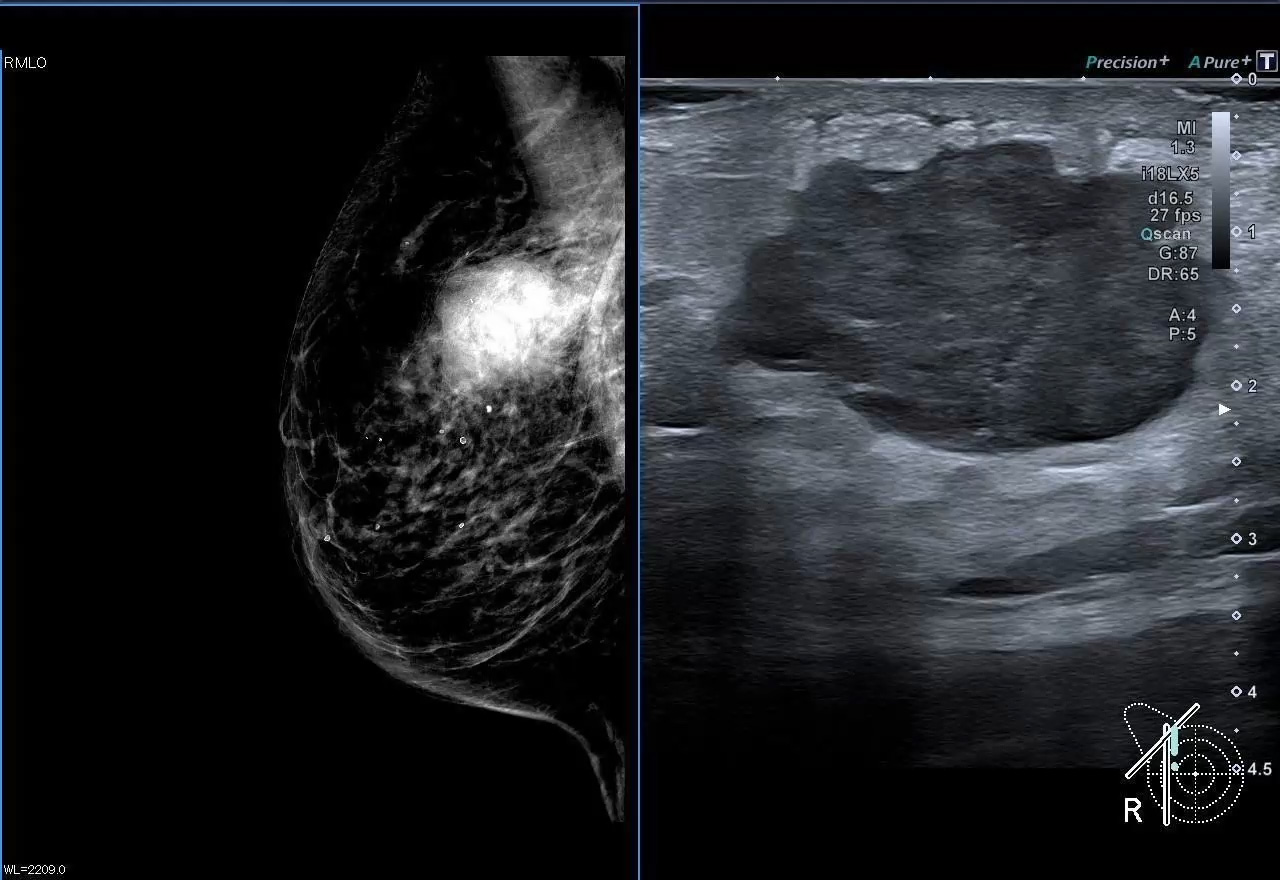 Reference Imaging Breast