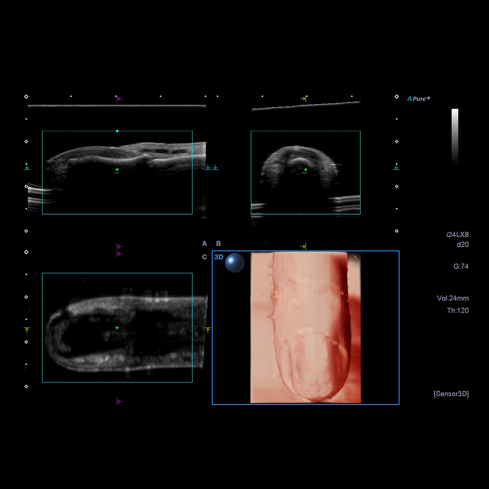 24 MHz Fingernail with Sensor 3D