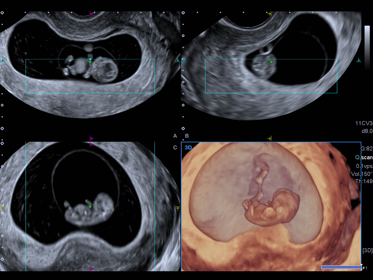 3D Embryo