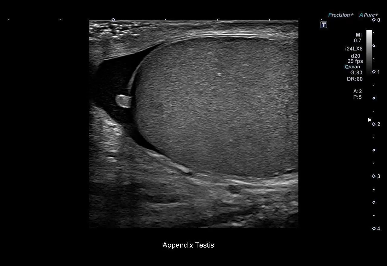 Testis - 24 MHz