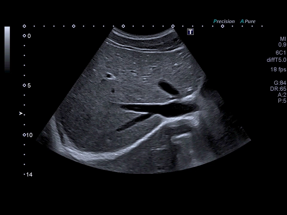 Xario g-series clinical ultrasound