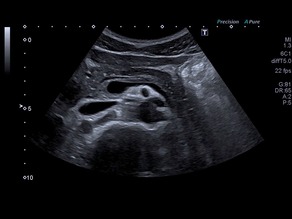 Xario g-series clinical ultrasound