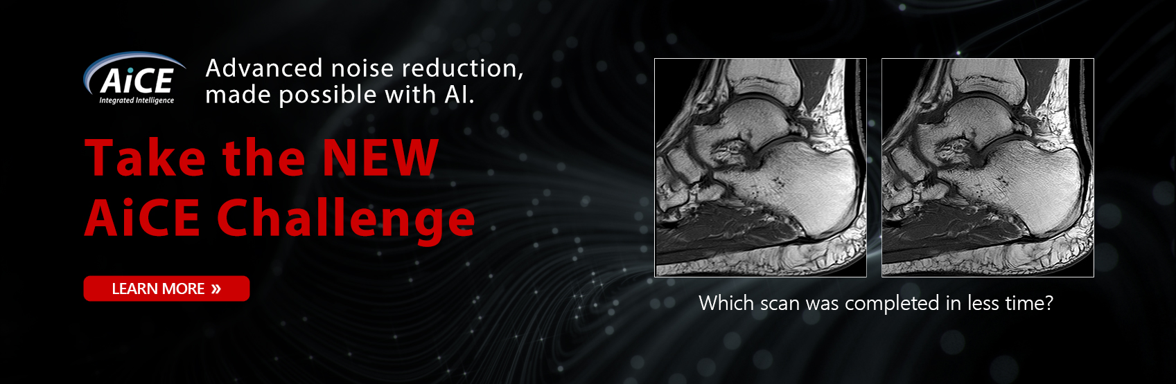 Advanced noise reduction, made possible with AI. Take the AiCE Challenge | Learn More