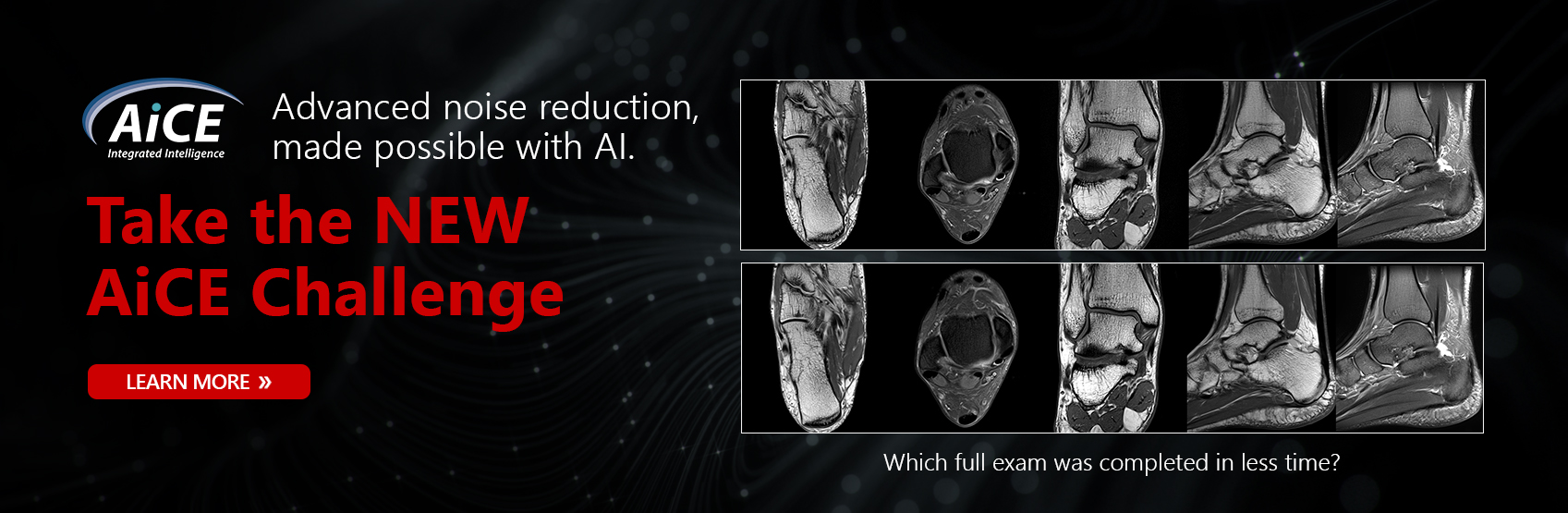 Advanced noise reduction, made possible with AI. Which full exam was completed in less time?  Take the NEW AiCE Challenge. | Learn More