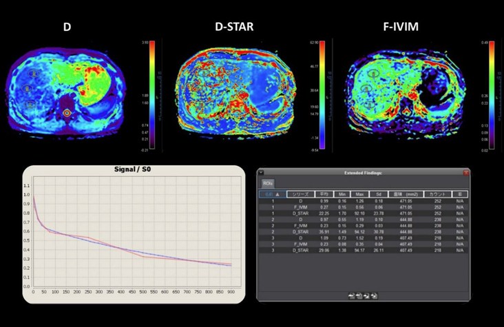 Imaging | Oncology Solutions | Canon Medical Systems USA