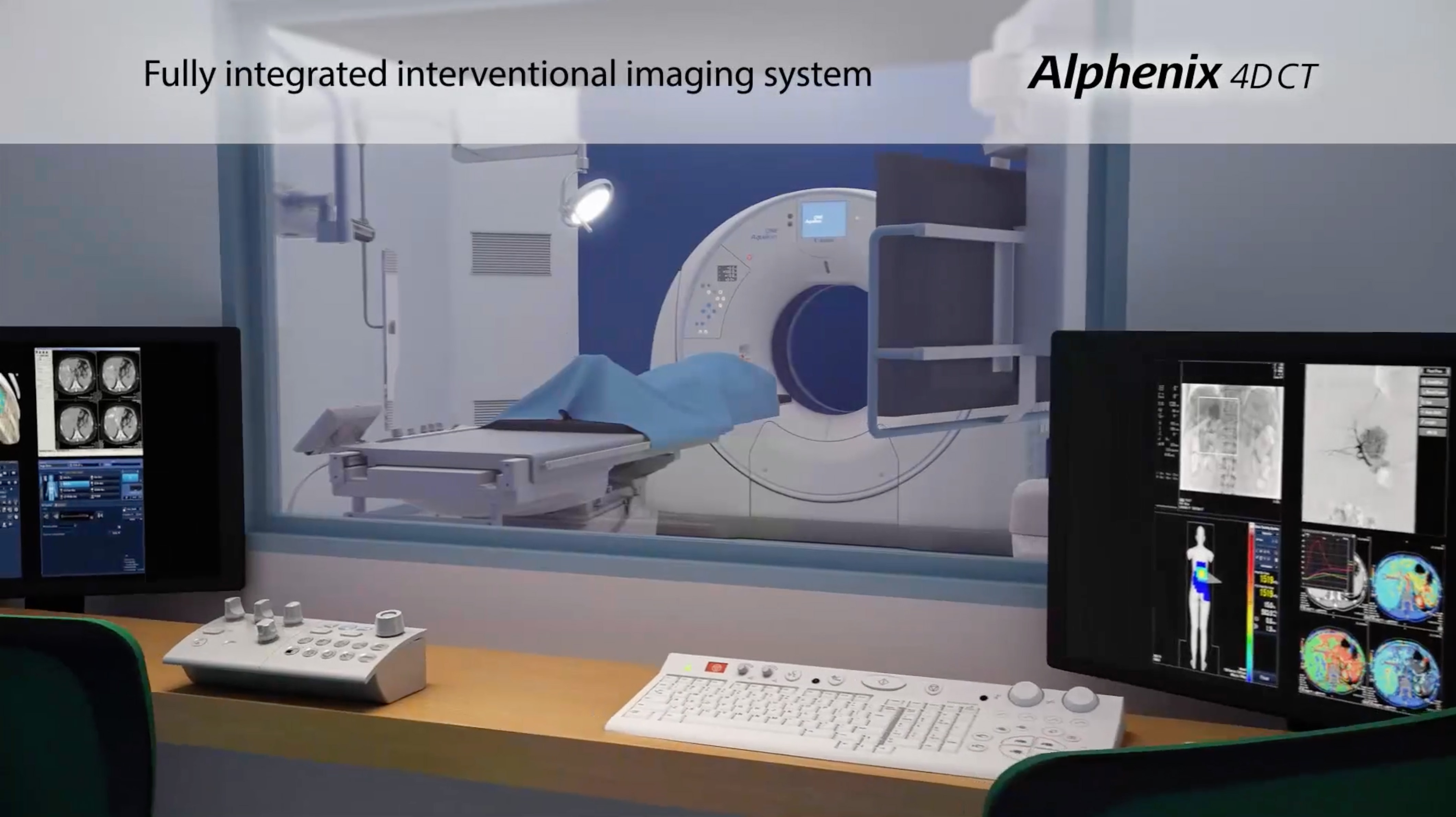 Alphenix 4D CT