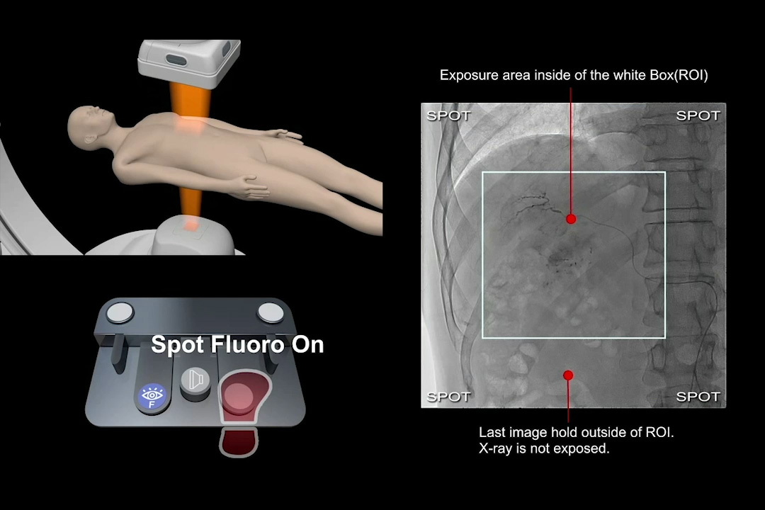 Spot Fluoroscopy