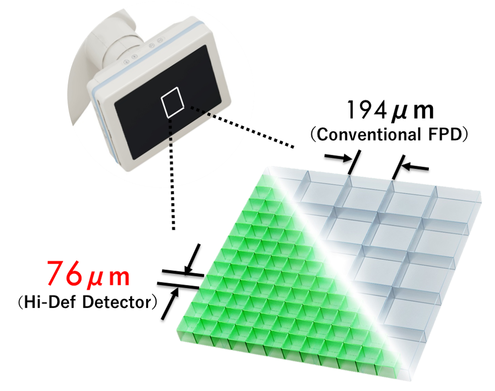 HD 76 Diagram