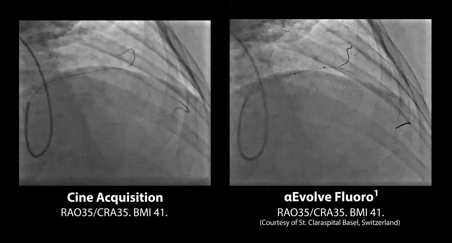 αEvolve Imaging