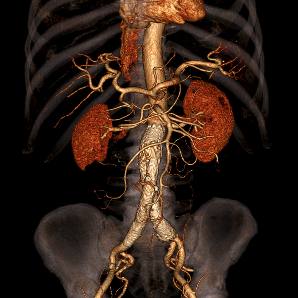 Aquilion 64 | ASSURANCE Refurbishment Program | Computed Tomography ...