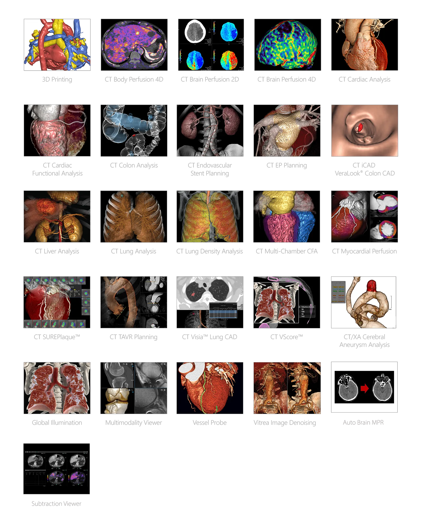 Vitrea Advanced Visualization Clinical Examples
