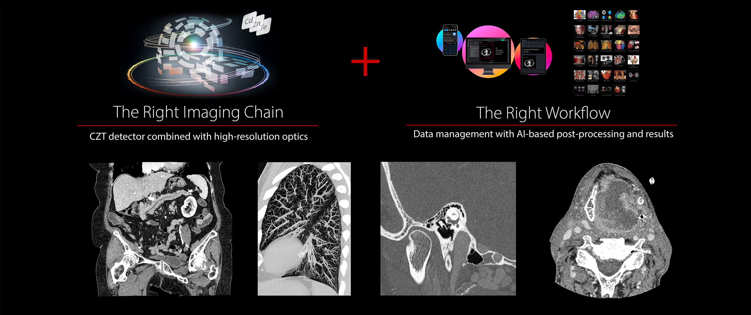 The Right Imaging Chain + The Right Workflow