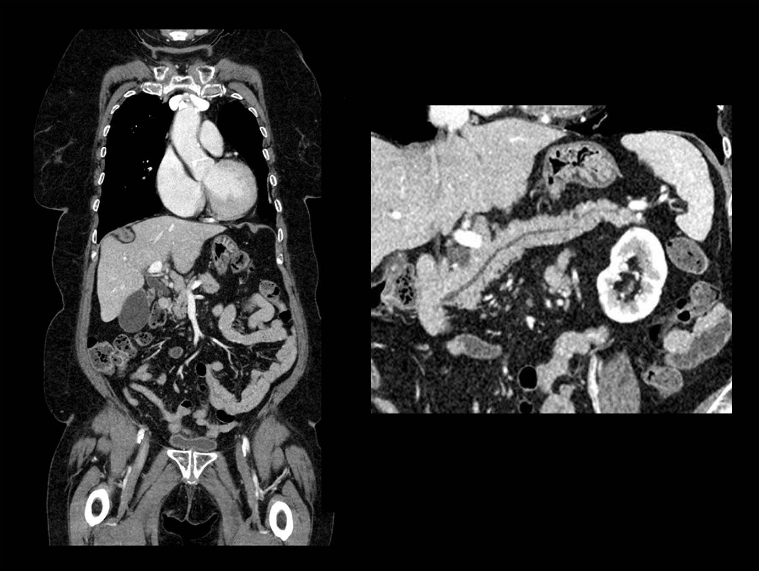 Whole Body Clinical Images