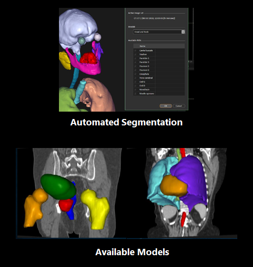 RaySearch: Automated Segmentation and Available Models