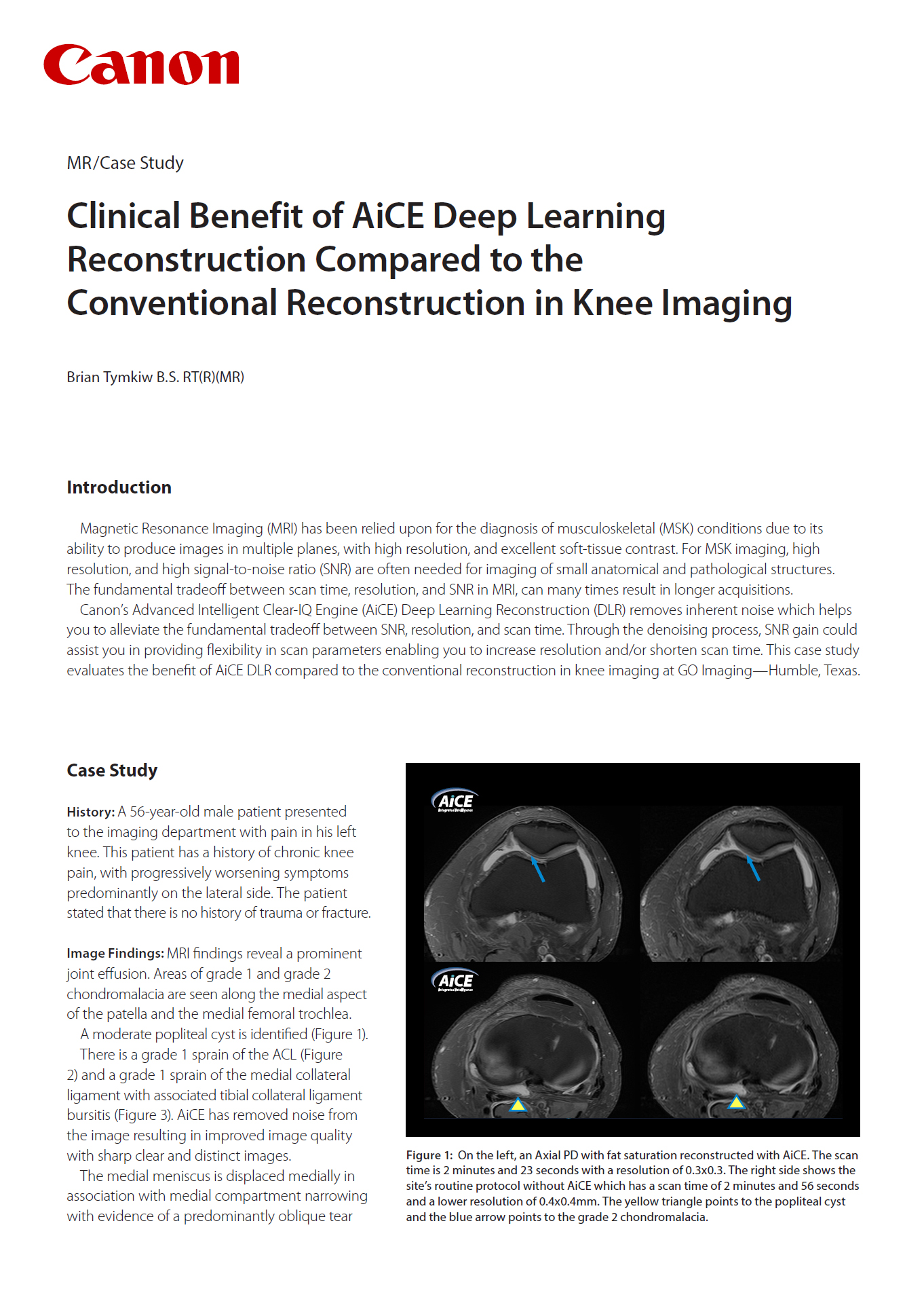 MR AiCE Knee Imaging Case Study