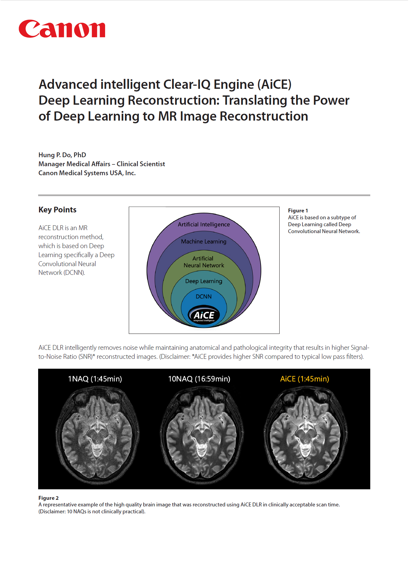 MR AiCE DLR: Translating the Power of Deep Learning to MR Reconstruction White Paper