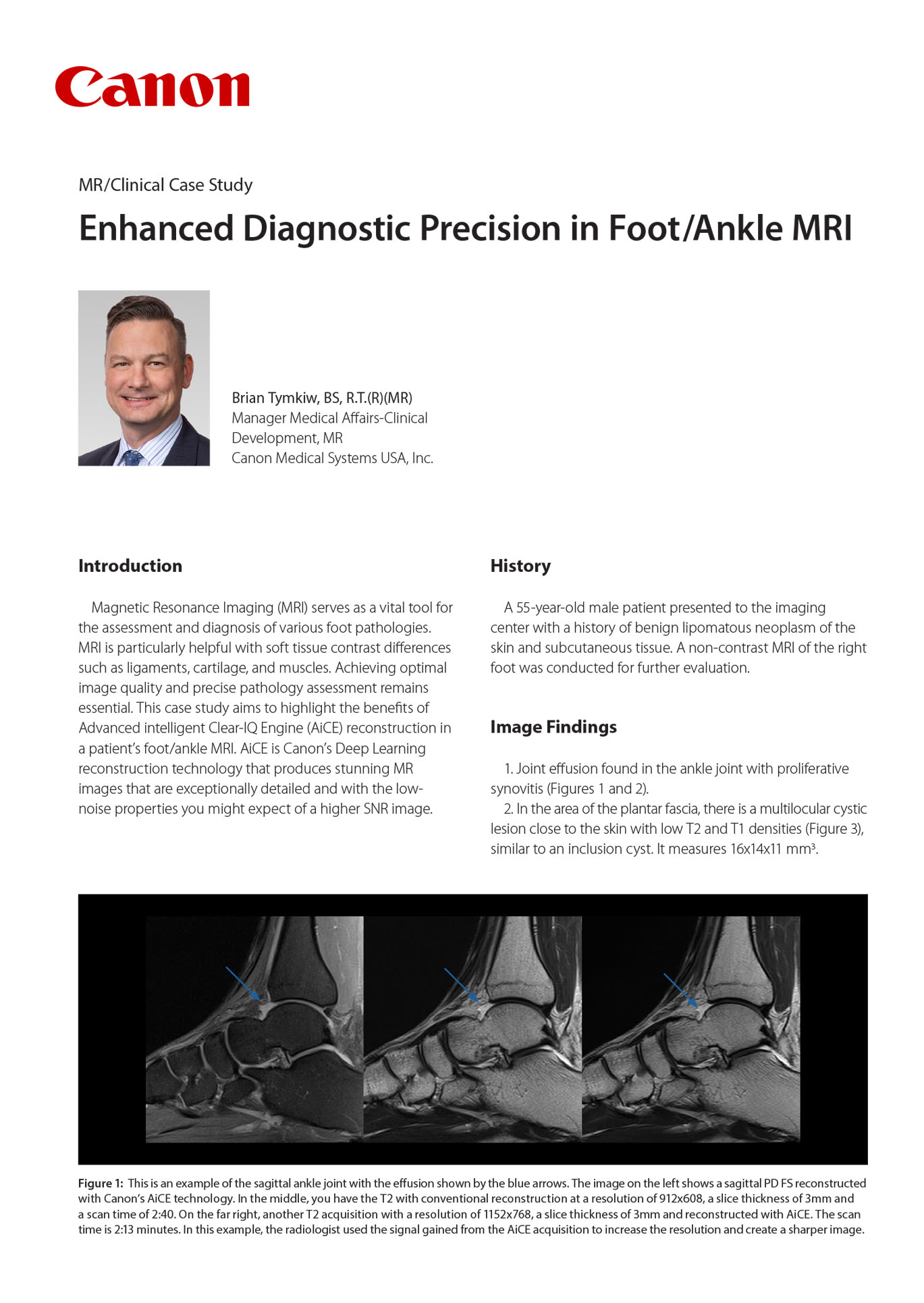 Enhanced Diagnostic Precision in Foot/Ankle MRI